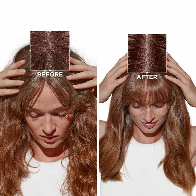 Kérastase Symbiose Micro-Peeling Cellulaire 500 ml - Trattamento micro-esfolliante